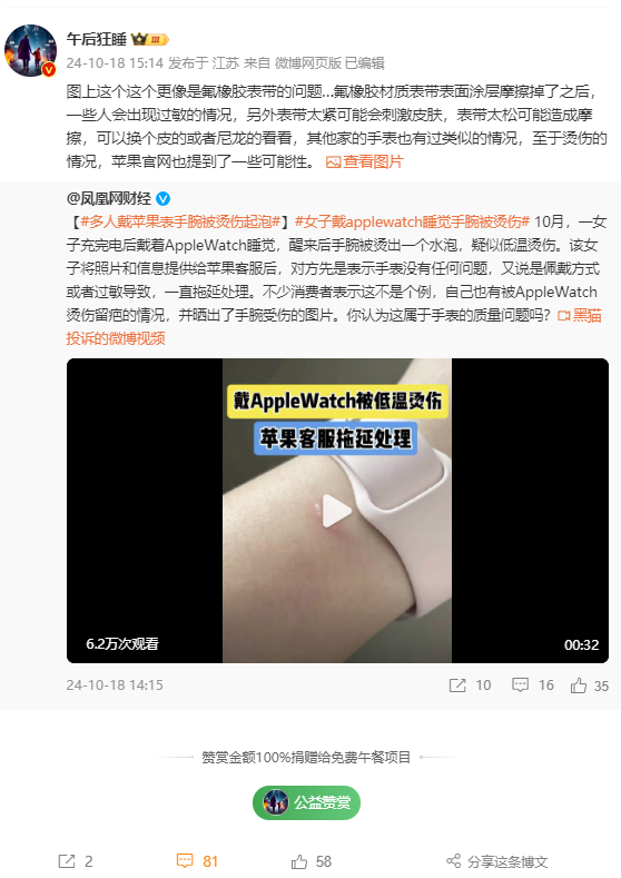 女子戴Apple Watch睡觉被烫伤起泡 苹果客服回应：过敏反应