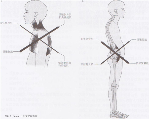 比散步还简单的动作！每天只需10分钟 就能改善体态、缓解肩颈痛