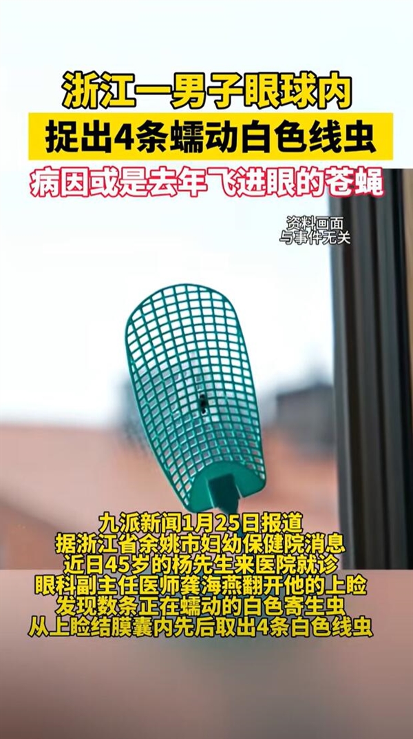 男子眼球内捉出4条蠕动线虫：左眼曾飞进去过一只苍蝇